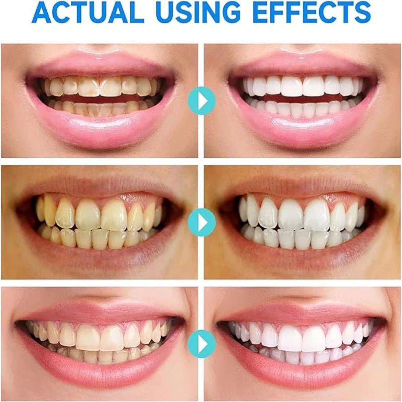 (1+1 FREE) WhiteAura™ Niacinamide Whitening Toothpaste - Lovitzo