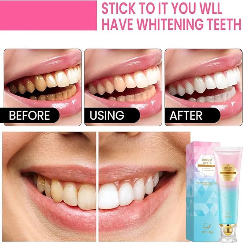 (1+1 FREE) WhiteAura™ Niacinamide Whitening Toothpaste - Lovitzo