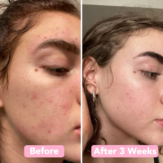 Lovitzo Turmeric & Kojic Acid Pads | 40 Pack