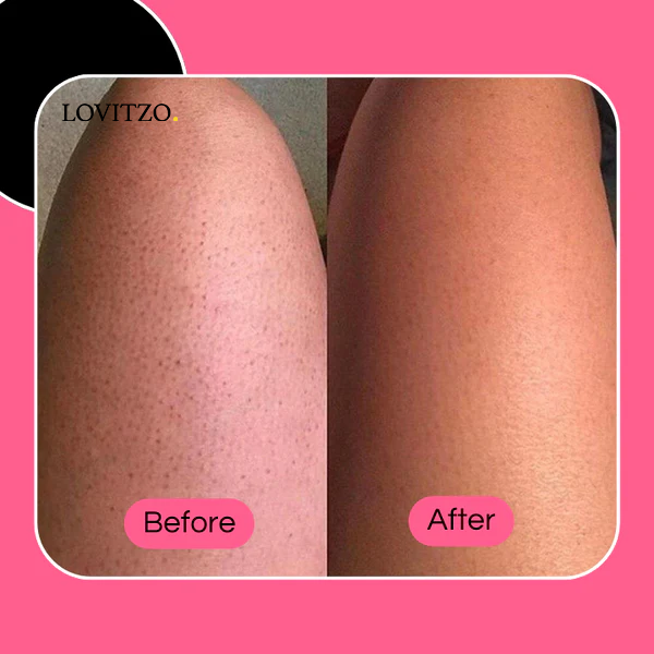 GlowySkin™ | SkinCare