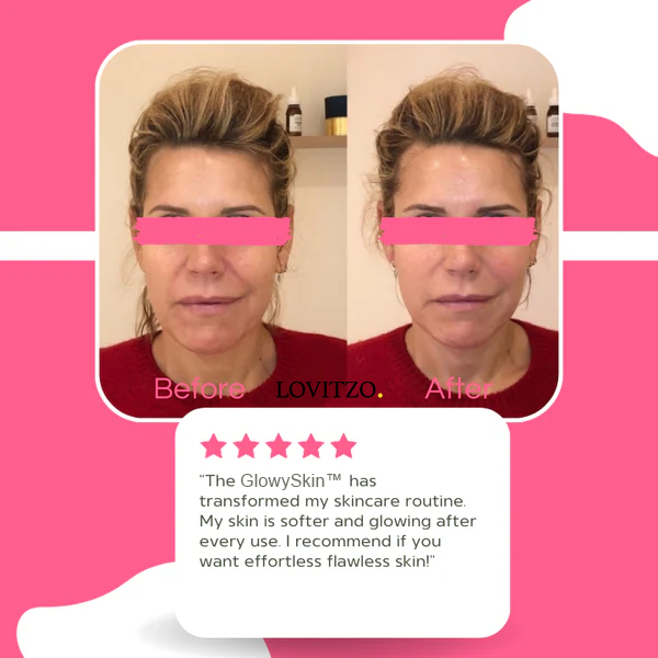 GlowySkin™ | SkinCare