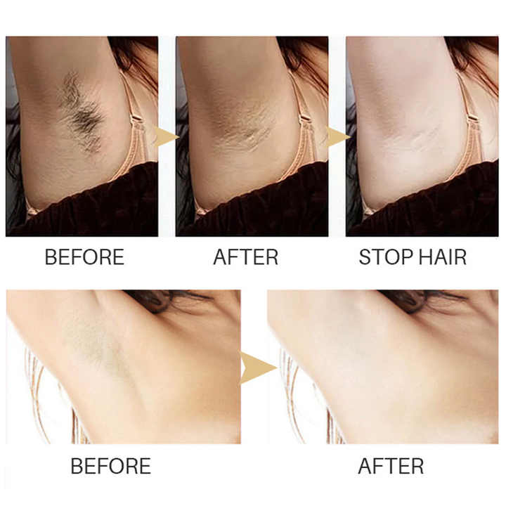SmoothSoothe™ / Smooth Skin Hair Removal Serum