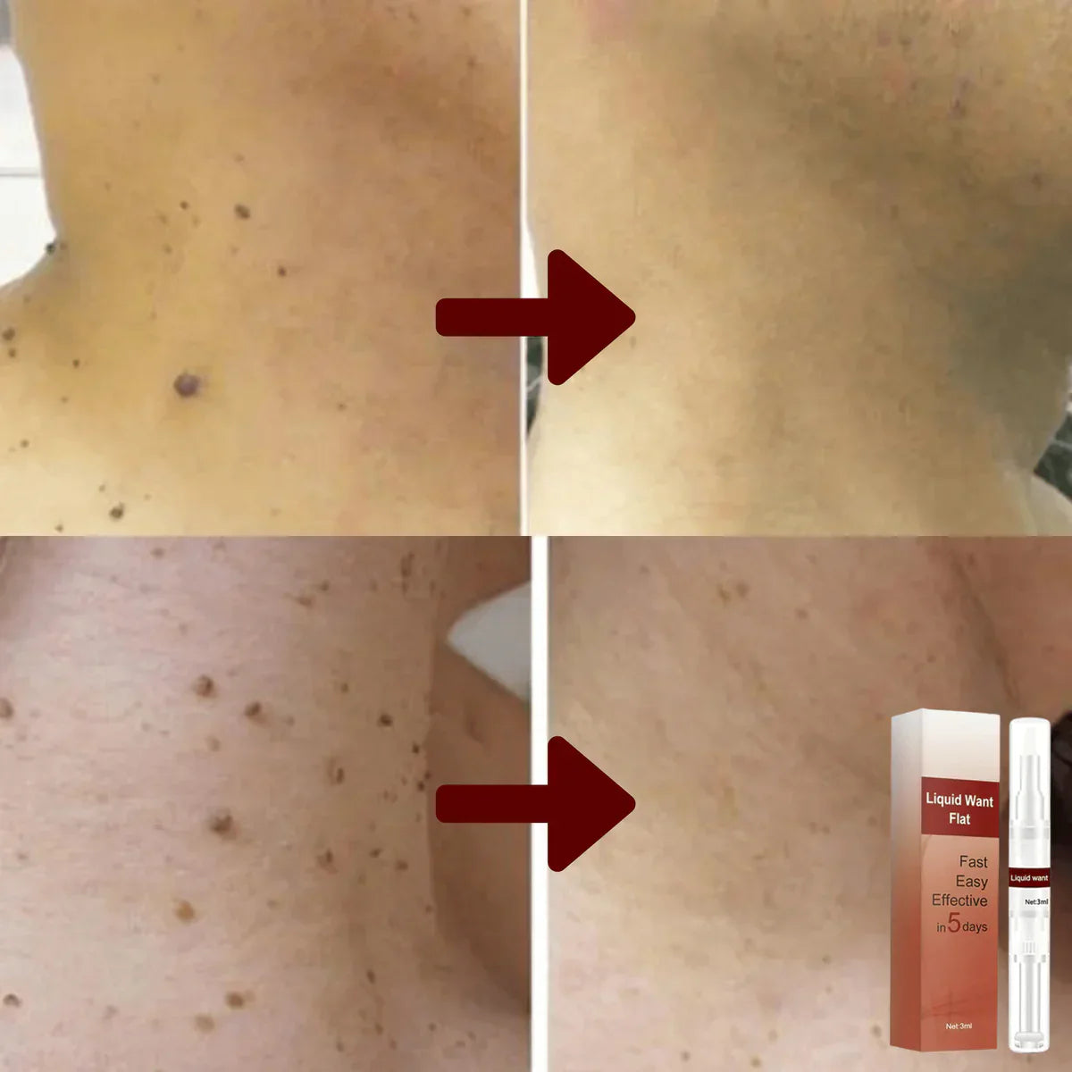 Nourishing Skin Serum with Tea Tree Oil & Herbal Extracts | Supports Clear Skin & Healthy Complexion