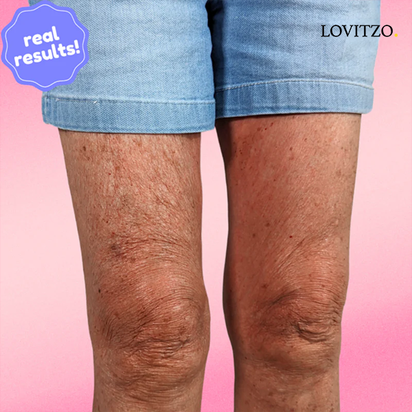 Instant Lift & Shine – Invisible Firming Patches