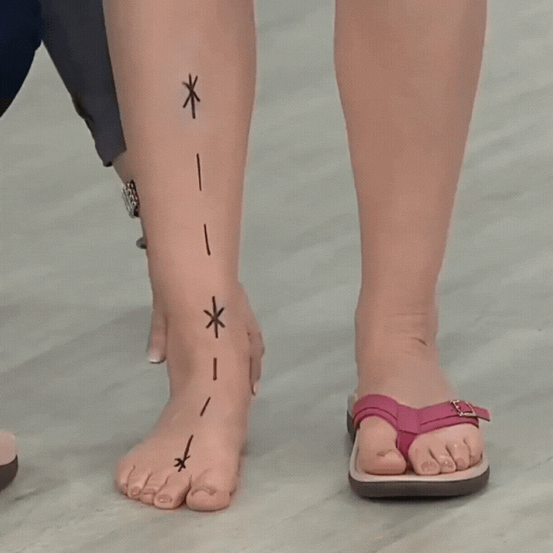 ComfiFeet™ | Orthopaedic Summer Sandals