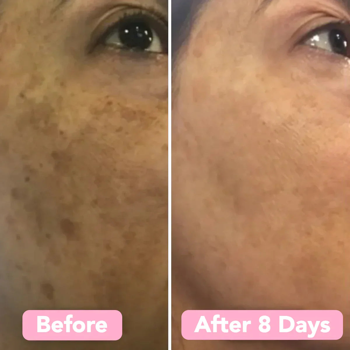 Lovitzo Turmeric & Kojic Acid Pads | 40 Pack