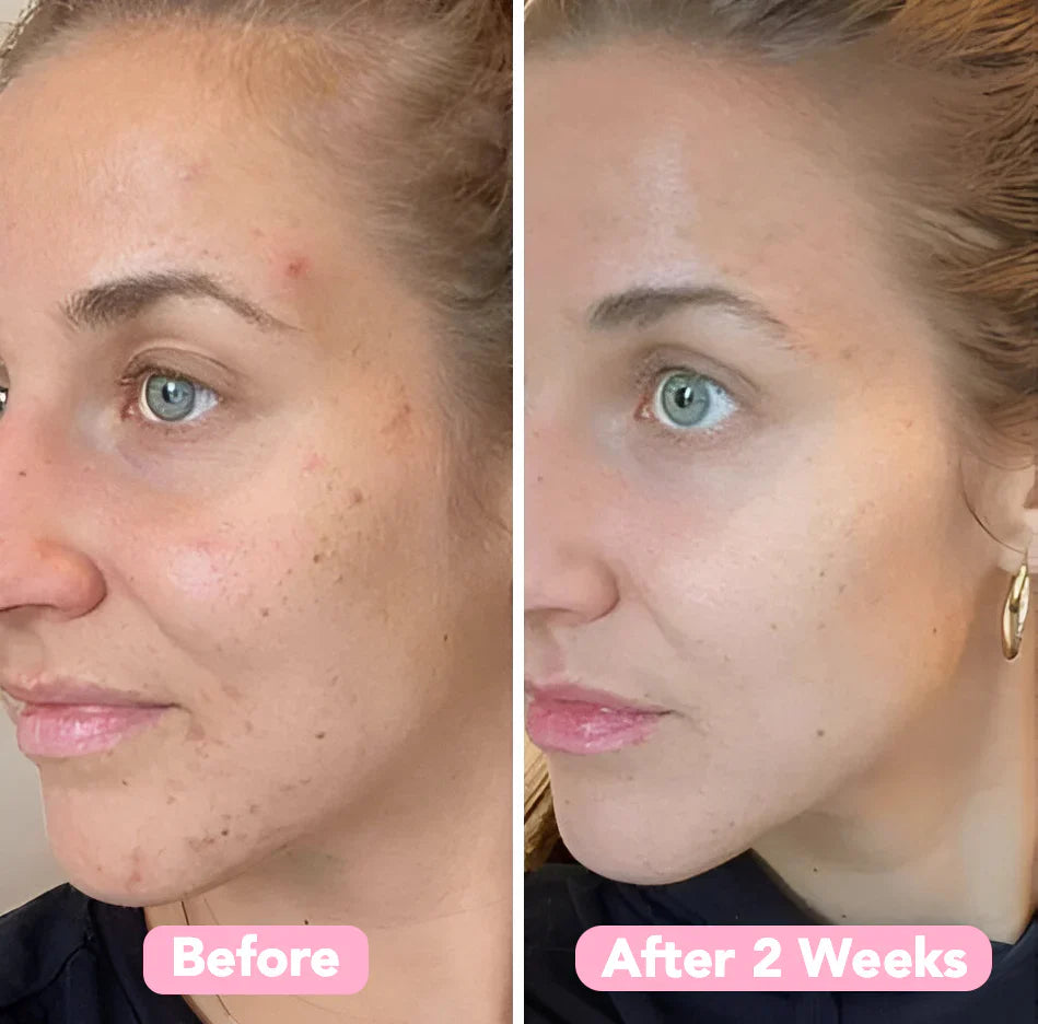 Lovitzo Turmeric & Kojic Acid Pads | 40 Pack