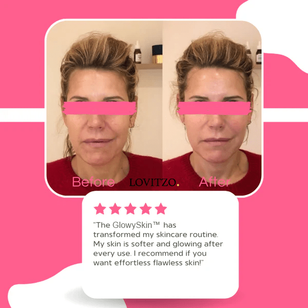 GlowySkin™ | SkinCare - Lovitzo