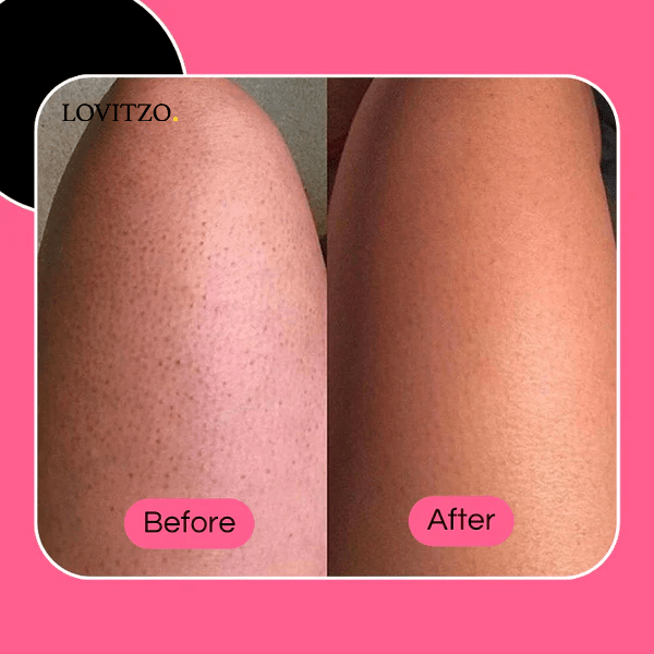 GlowySkin™ | SkinCare - Lovitzo