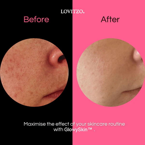 GlowySkin™ | SkinCare - Lovitzo