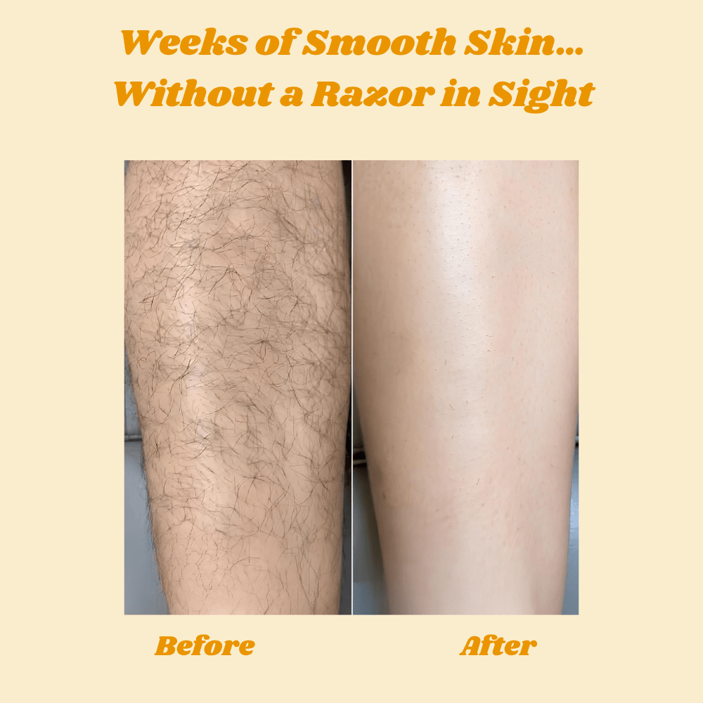 HoneySmooth™ — Experience Pain - Free, Irresistibly Smooth Skin That Lasts Weeks - Lovitzo