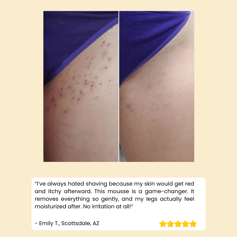 HoneySmooth™ — Experience Pain - Free, Irresistibly Smooth Skin That Lasts Weeks - Lovitzo