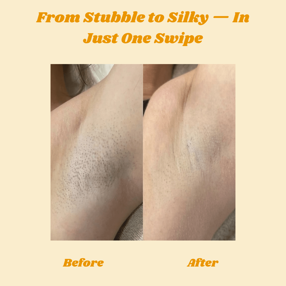 HoneySmooth™ — Experience Pain - Free, Irresistibly Smooth Skin That Lasts Weeks - Lovitzo