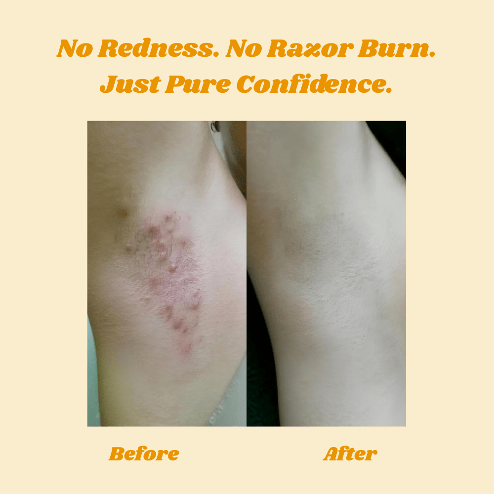 HoneySmooth™ — Experience Pain - Free, Irresistibly Smooth Skin That Lasts Weeks - Lovitzo