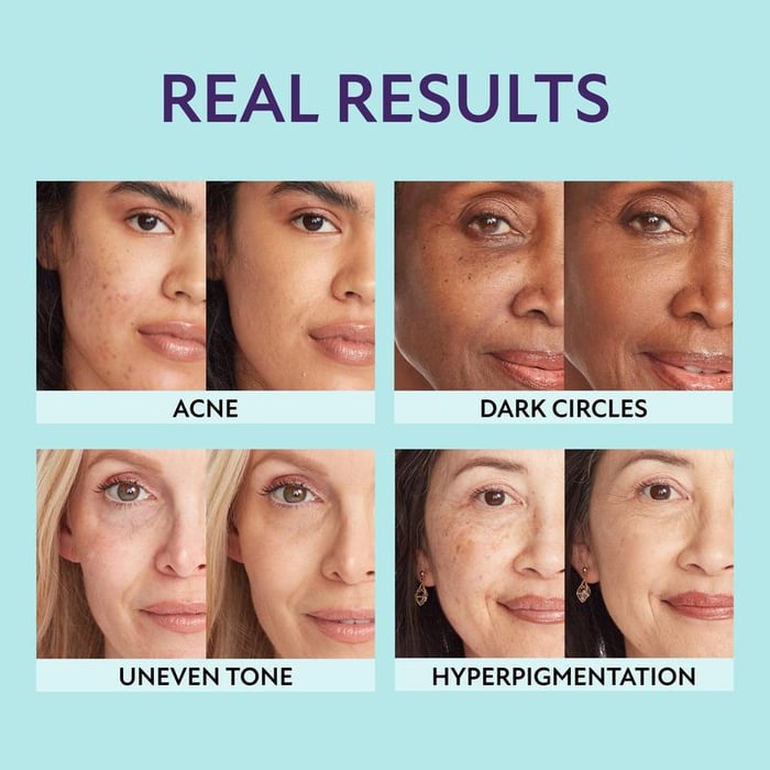Hydrating Concealer with Natural Coverage Finish - NovaCrème - Lovitzo