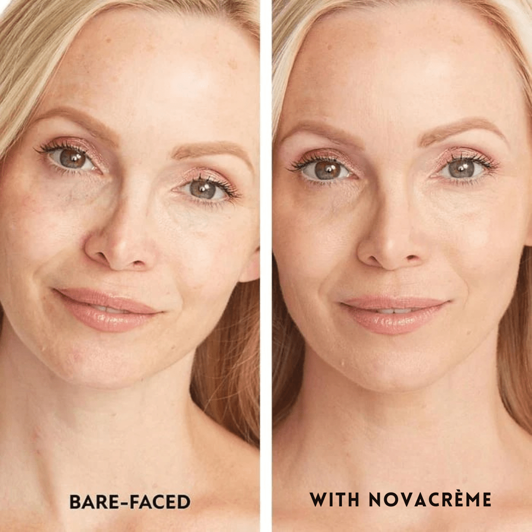 Hydrating Concealer with Natural Coverage Finish - NovaCrème - Lovitzo