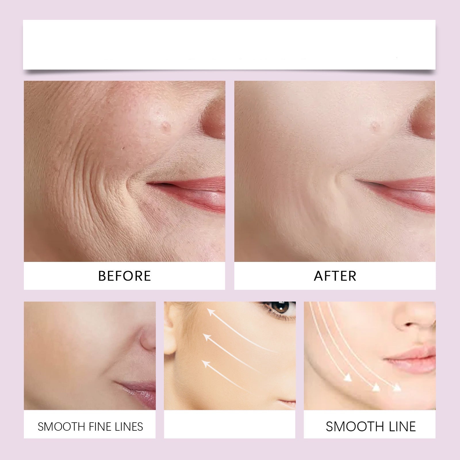 Lovitzo Invisible Face Lift Tape