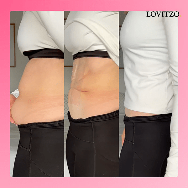 Instant Lift & Shine – Invisible Firming Patches - Lovitzo