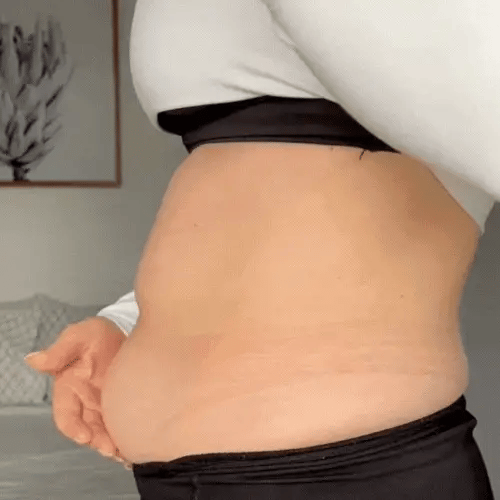 Instant Lift & Shine – Invisible Firming Patches - Lovitzo