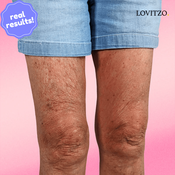 Instant Lift & Shine – Invisible Firming Patches - Lovitzo
