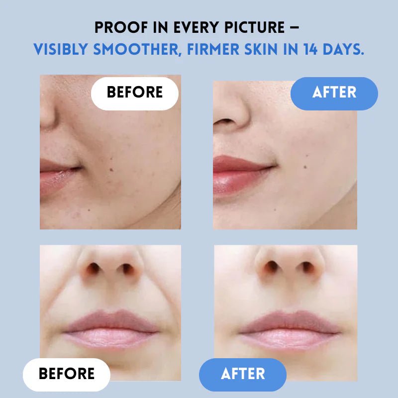 LiftLure - Renew Strips for Ageless Radiance - Lovitzo