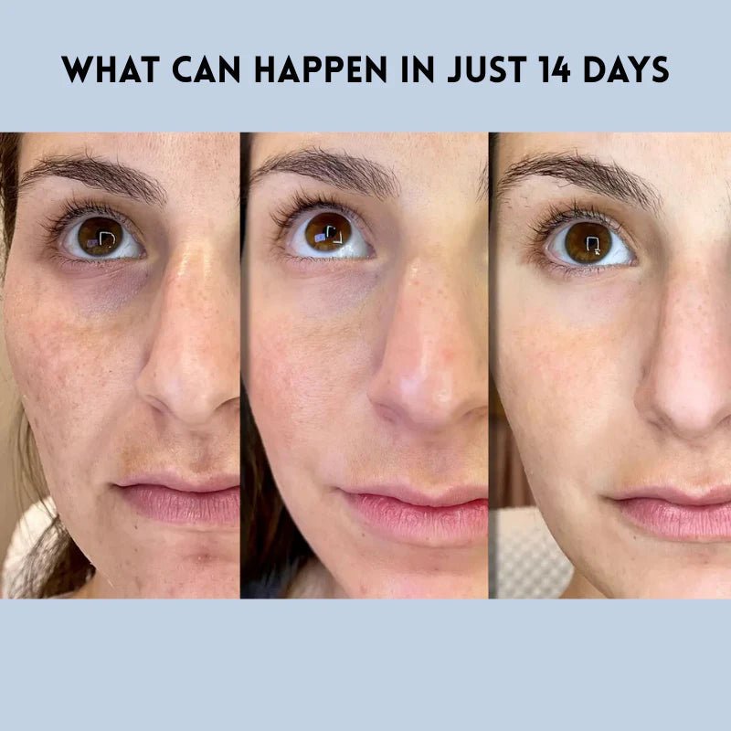 LiftLure - Renew Strips for Ageless Radiance - Lovitzo