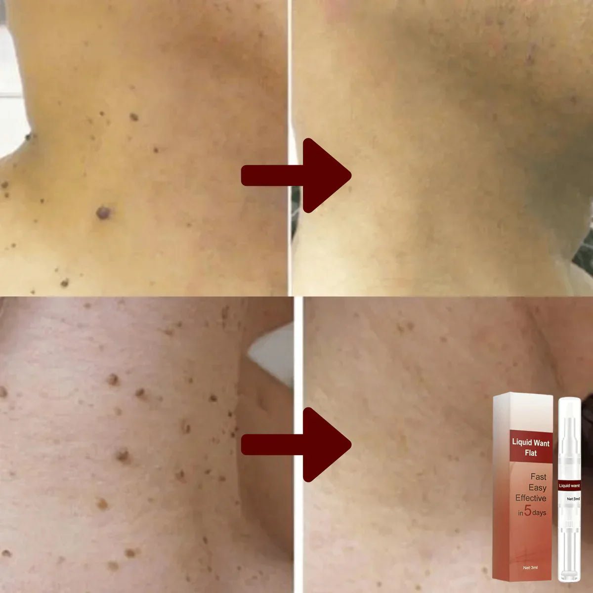 Nourishing Skin Serum with Tea Tree Oil & Herbal Extracts | Supports Clear Skin & Healthy Complexion - Lovitzo