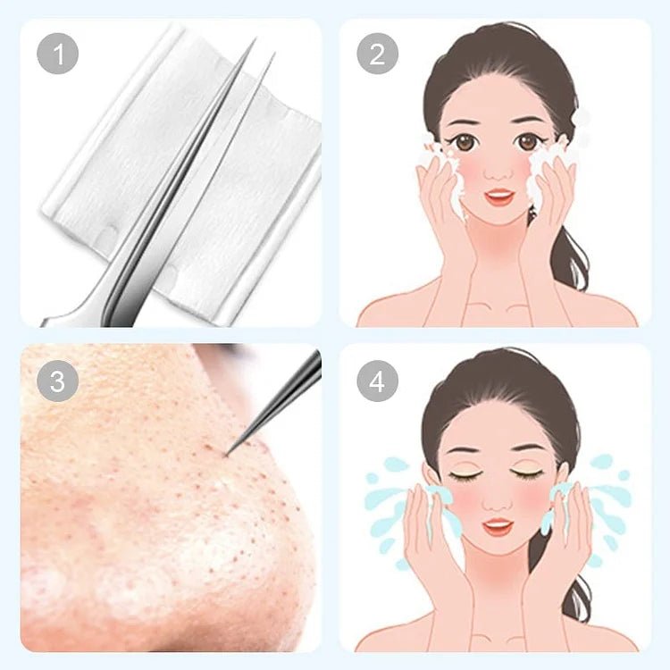 PoreCare Pro™ / Stainless Steel Blackhead Removal Tool Set - Lovitzo