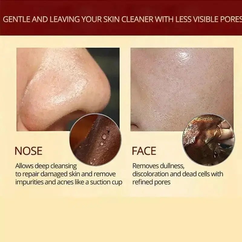 Premium - Herbal Refining Peel - Off Facial Mask - Lovitzo