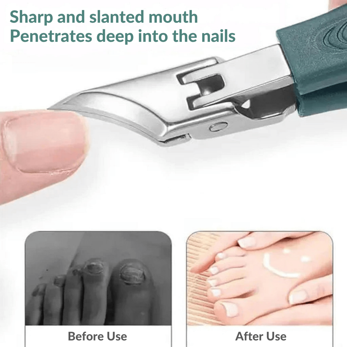 ProClip – Nail Care Tool Set - Lovitzo