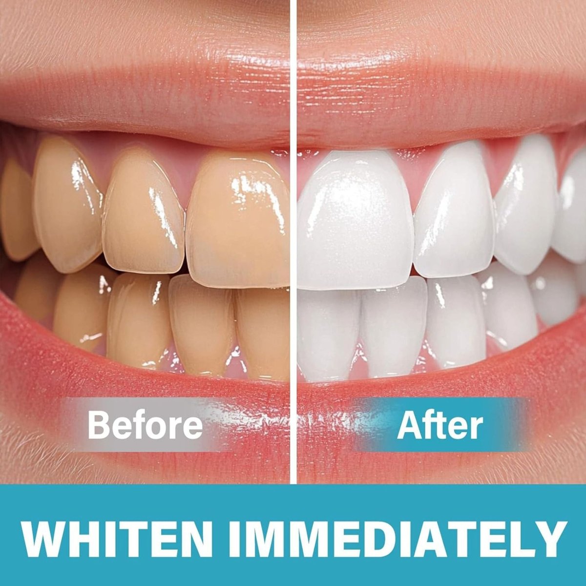 PureSmile - Instant Teeth Whitening Pigment Without Sensitivity - Lovitzo