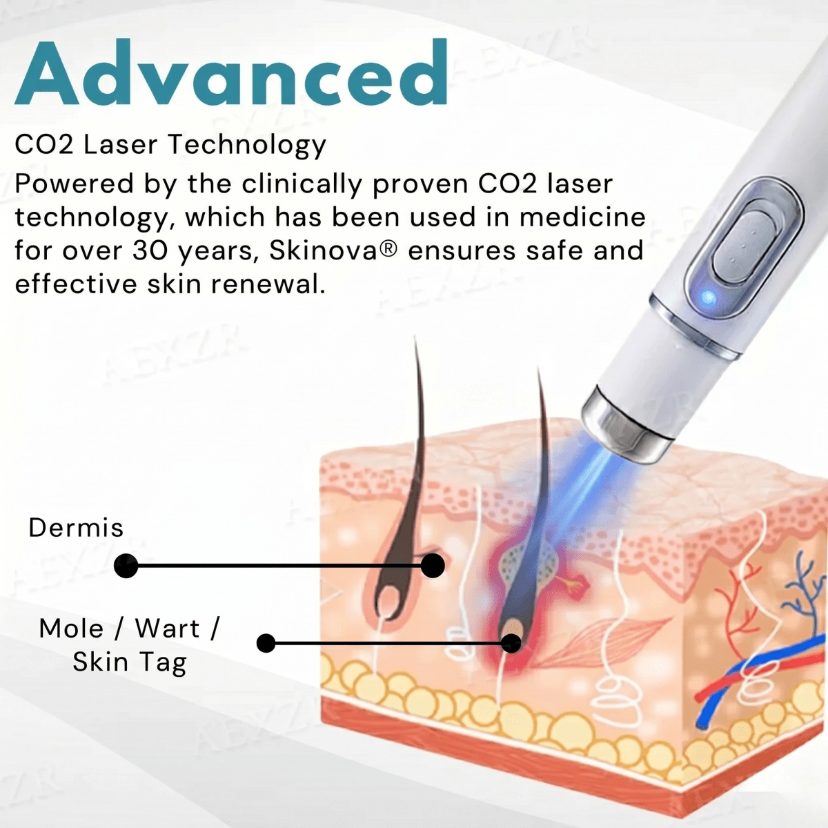 Skinova - Fast Skin Rejuvenation [Last Day Discount] - Lovitzo