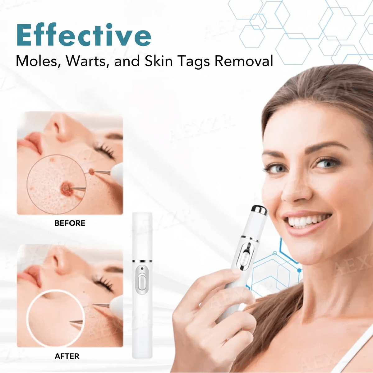 Skinova - Fast Skin Rejuvenation [Last Day Discount] - Lovitzo