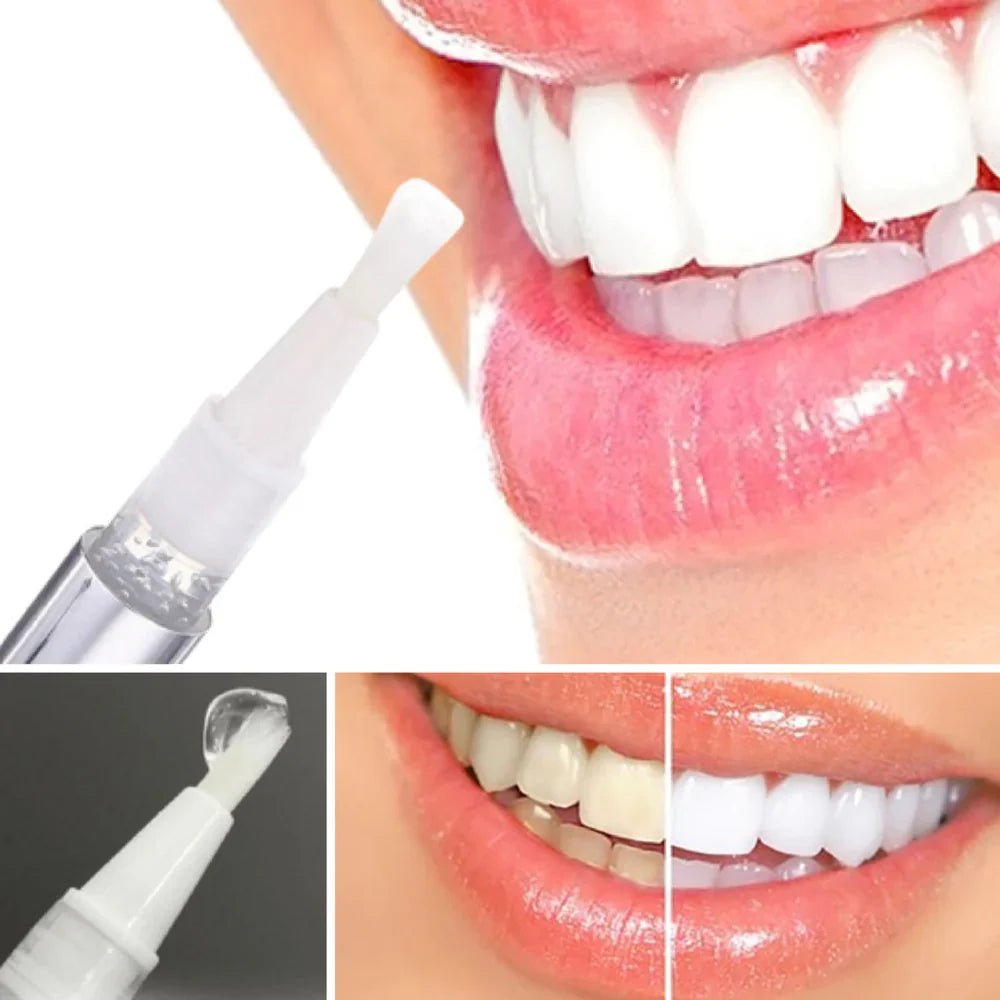 Teeth Whitening Pen - Radiant smile in 10 minutes - Lovitzo