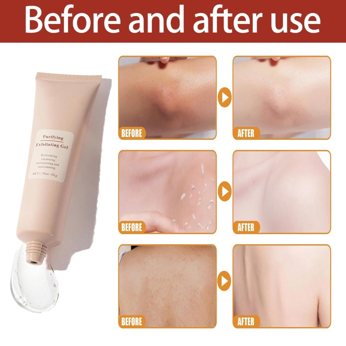 Velyra / Exfoliating Gel - Radiant Skin in 1 minute - Lovitzo