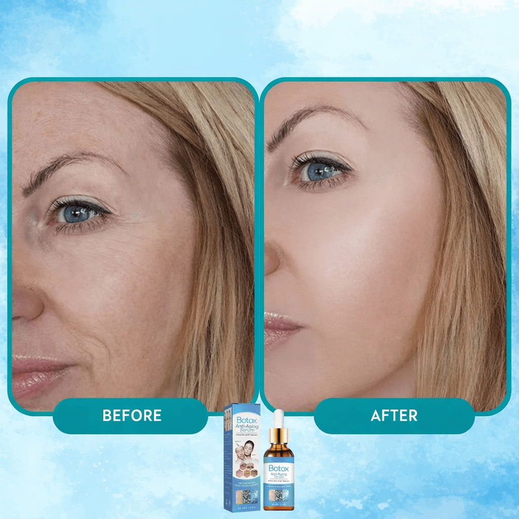 YouthSerum - Botox Anti - aging Serum (1 + 1 FREE TODAY) - Lovitzo