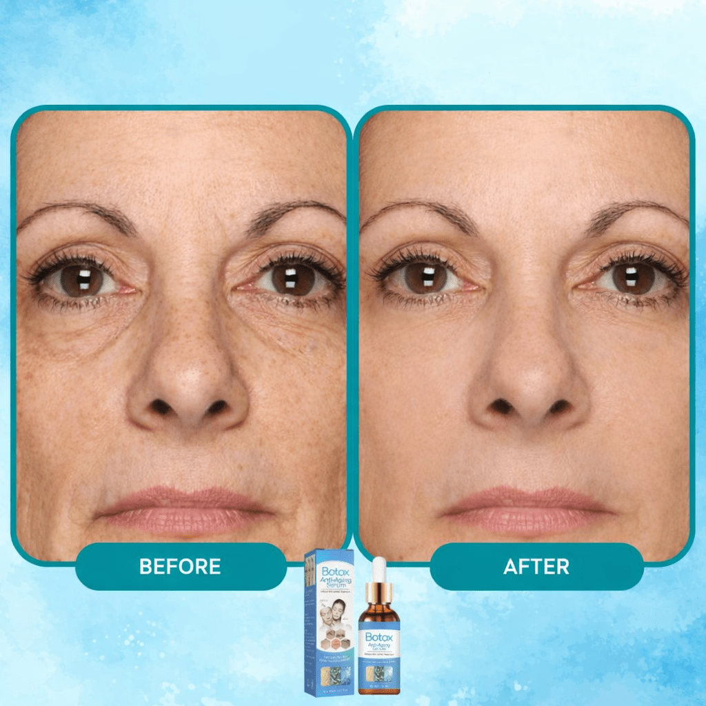 YouthSerum - Botox Anti - aging Serum (1 + 1 FREE TODAY) - Lovitzo