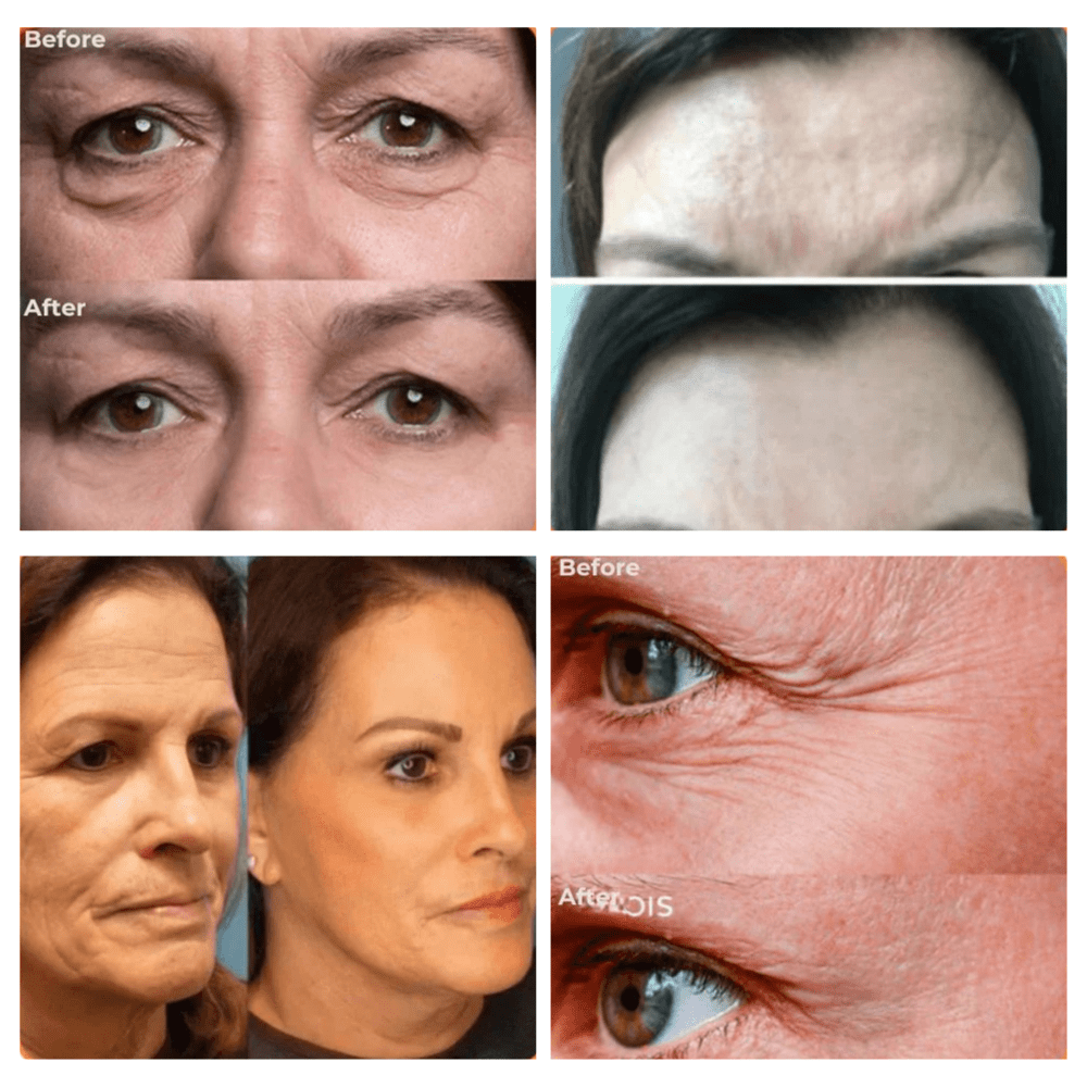 YouthSync™ — Erase Fine Lines & Glow Naturally | 1+1 FREE Today - Lovitzo
