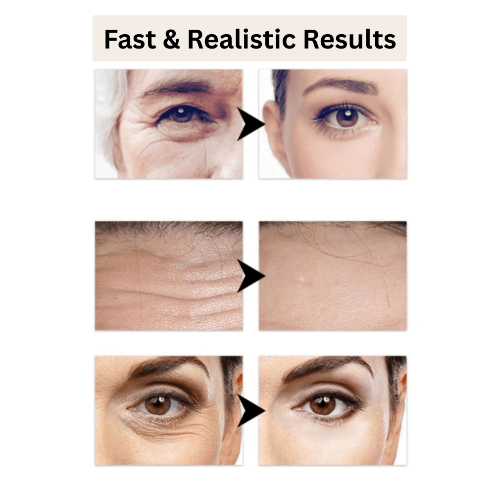 YouthSync™ — Erase Fine Lines & Glow Naturally | 1+1 FREE Today - Lovitzo